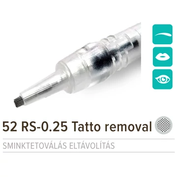 NPM 52 RS-0.25 Tattoo Removal