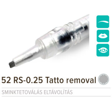 NPM 52 RS-0.25 Tattoo Removal